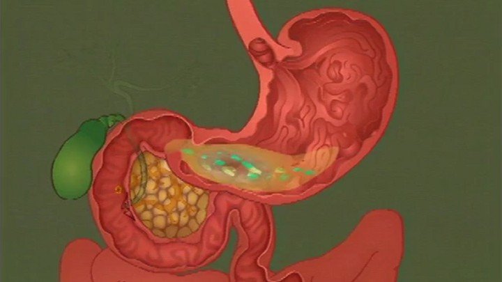 The Digestive System, Nutrition & Metabolism