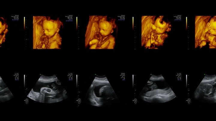 The Ethics of Abortion: When Does Life Begin?