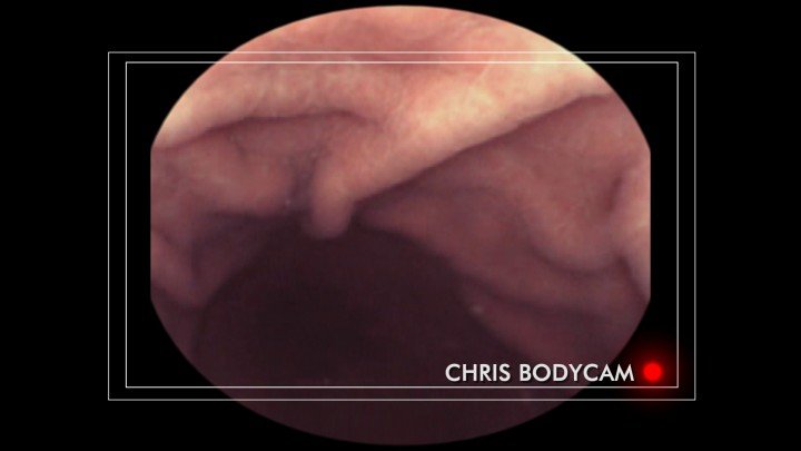 Operation Ouch! – S01E10