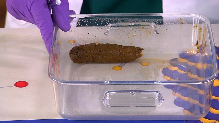 Operation Ouch! – S01E11