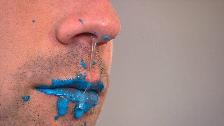 Operation Ouch! – S02E10