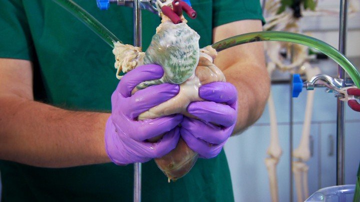 Operation Ouch! – S03E02