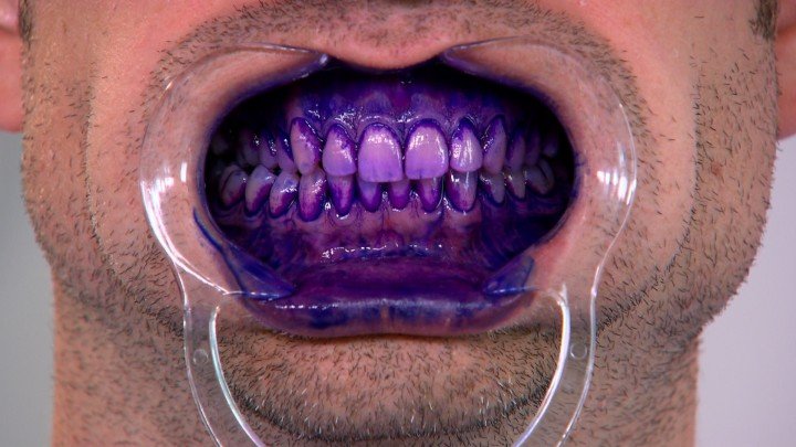Operation Ouch! – S03E10