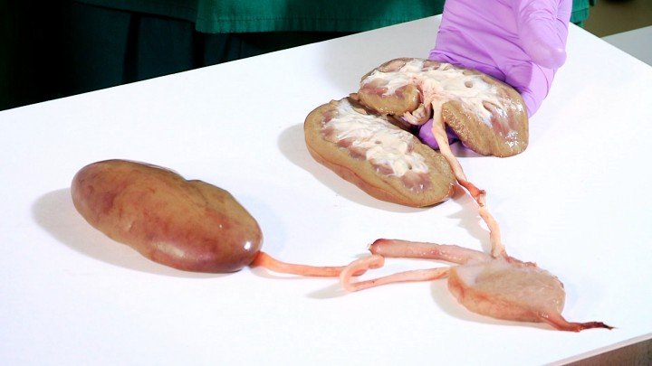 Operation Ouch! – S04E06